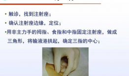 输液港维护视频,轻松掌握输液港日常维护技巧